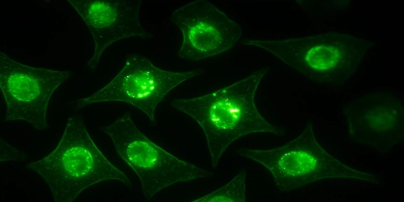 Fluorescent calcium ion release in cells under microscope in biomedical study Fluorescent calcium ion release in cells under microscope in biomedical study